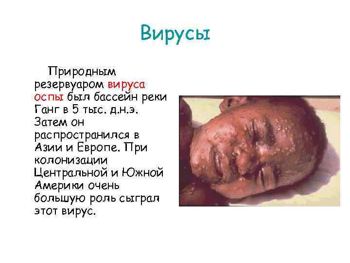 Вирусы Природным резервуаром вируса оспы был бассейн реки Ганг в 5 тыс. д. н.