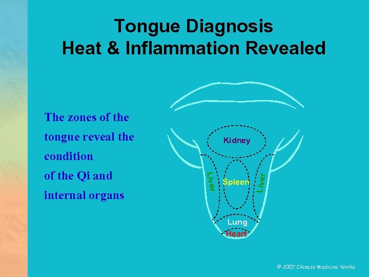 Tongue Diagnosis Heat & Inflammation Revealed The zones of the tongue reveal the Kidney