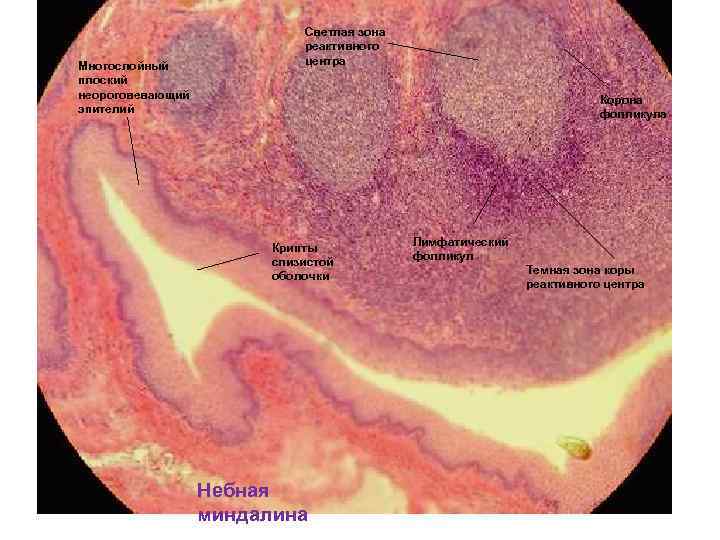 Многослойный плоский неороговевающий эпителий Светлая зона реактивного центра Корона фолликула Крипты слизистой оболочки Небная