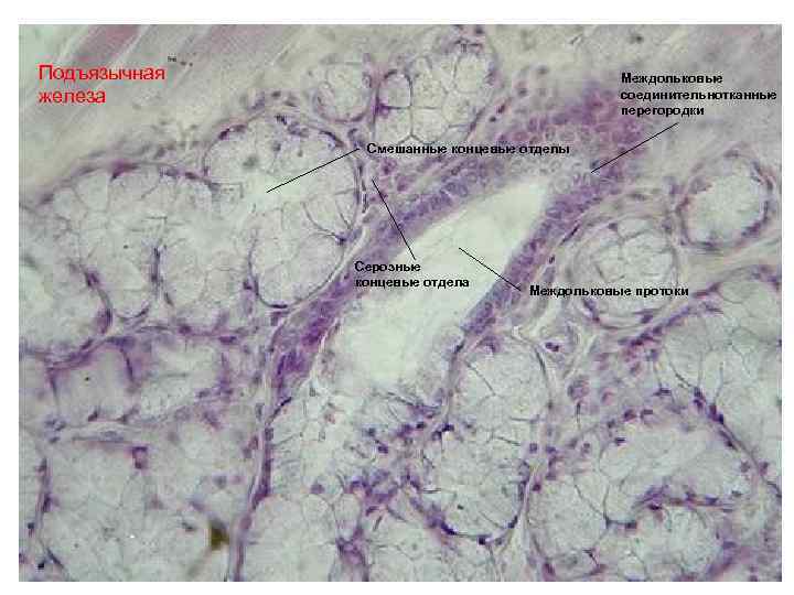 Подъязычная железа Междольковые соединительнотканные перегородки Смешанные концевые отделы Серозные концевые отдела Междольковые протоки 