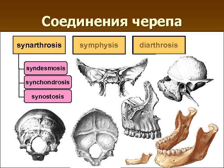 Соединения черепа synarthrosis syndesmosis synсhondrosis synostosis symphysis diarthrosis 