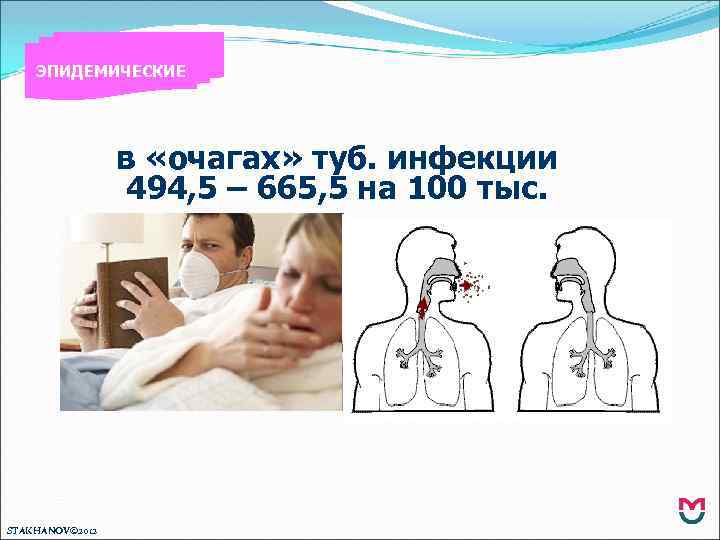 ЭПИДЕМИЧЕСКИЕ в «очагах» туб. инфекции 494, 5 – 665, 5 на 100 тыс. STAKHANOV©