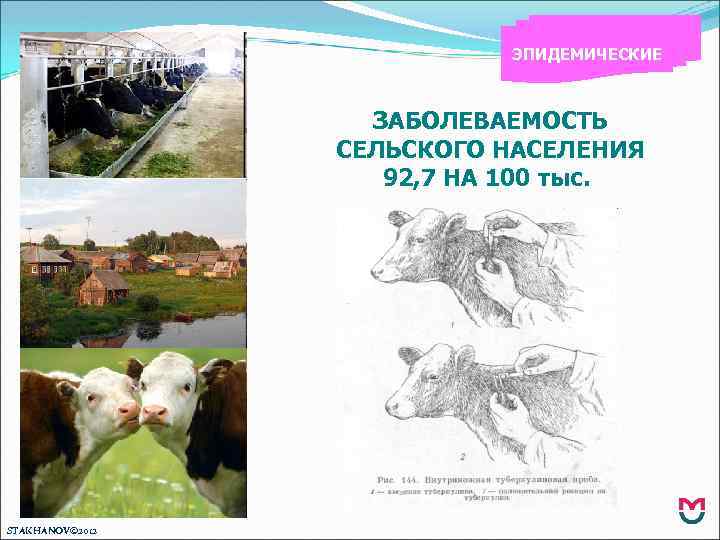 ЭПИДЕМИЧЕСКИЕ ЗАБОЛЕВАЕМОСТЬ СЕЛЬСКОГО НАСЕЛЕНИЯ 92, 7 НА 100 тыс. STAKHANOV© 2012 