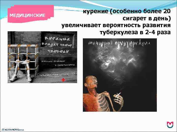 МЕДИЦИНСКИЕ STAKHANOV© 2012 курение (особенно более 20 сигарет в день) увеличивает вероятность развития туберкулеза