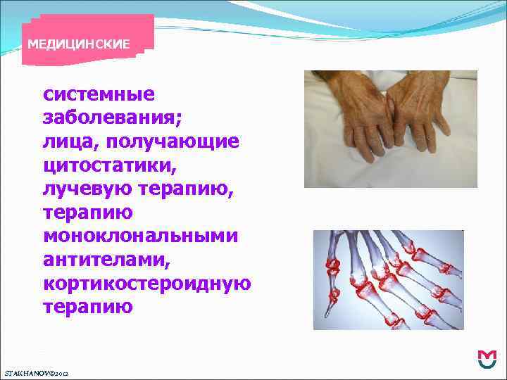 МЕДИЦИНСКИЕ системные заболевания; лица, получающие цитостатики, лучевую терапию, терапию моноклональными антителами, кортикостероидную терапию STAKHANOV©