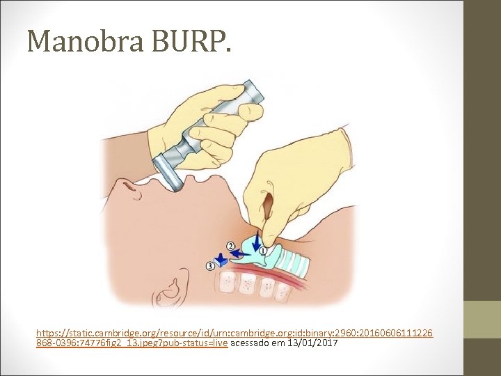 Manobra BURP. https: //static. cambridge. org/resource/id/urn: cambridge. org: id: binary: 2960: 20160606111226 868 -0396: