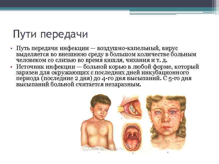 Пути передачи • Путь передачи инфекции — воздушно-капельный, вирус выделяется во внешнюю среду в