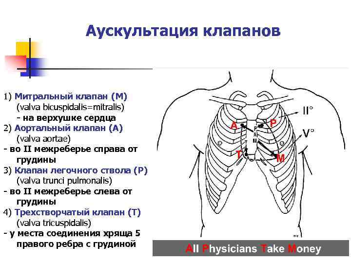 Шум остина флинта выслушивается в точке обозначенной на рисунке цифрой