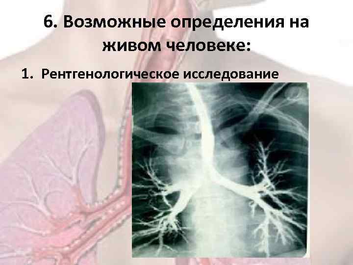 6. Возможные определения на живом человеке: 1. Рентгенологическое исследование 