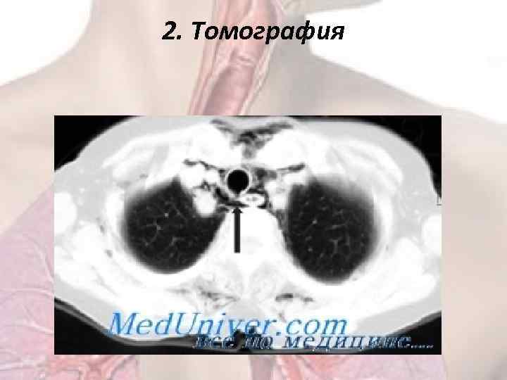 2. Томография 