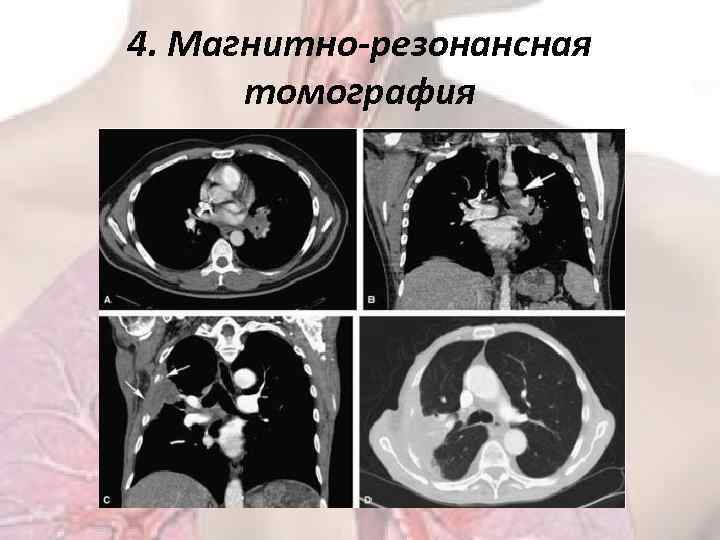 4. Магнитно-резонансная томография 