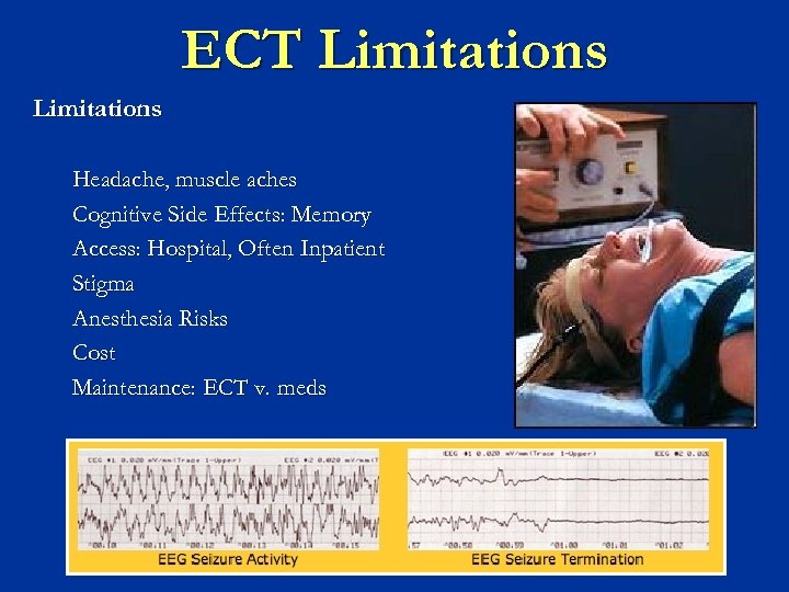 ECT Limitations Headache, muscle aches Cognitive Side Effects: Memory Access: Hospital, Often Inpatient Stigma