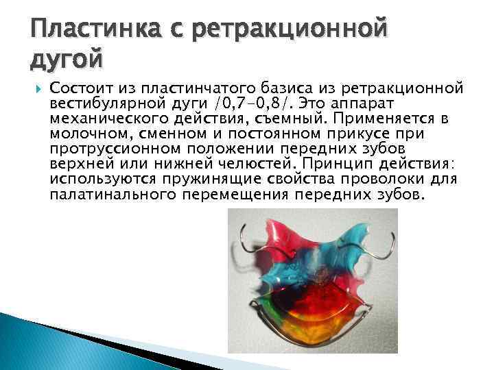 Пластинка с ретракционной дугой Состоит из пластинчатого базиса из ретракционной вестибулярной дуги /0, 7