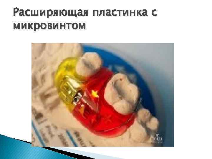 Расширяющая пластинка с микровинтом 