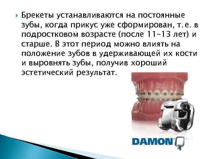  Брекеты устанавливаются на постоянные зубы, когда прикус уже сформирован, т.  е. в подростковом