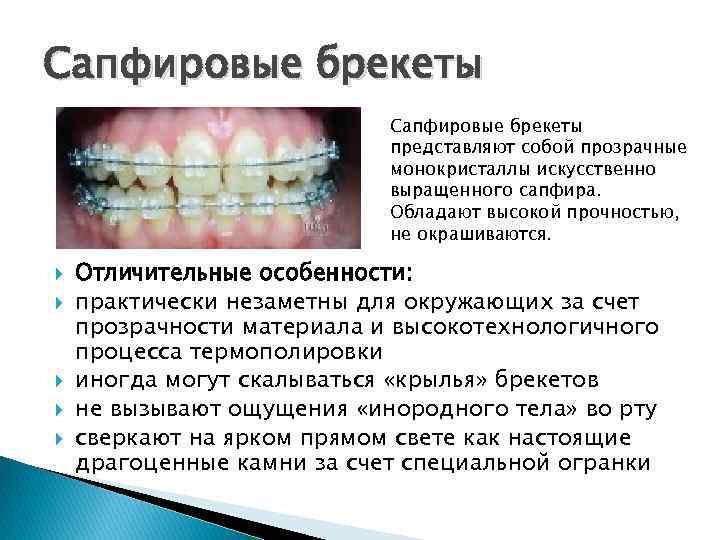 Сапфировые брекеты представляют собой прозрачные монокристаллы искусственно выращенного сапфира. Обладают высокой прочностью, не окрашиваются.