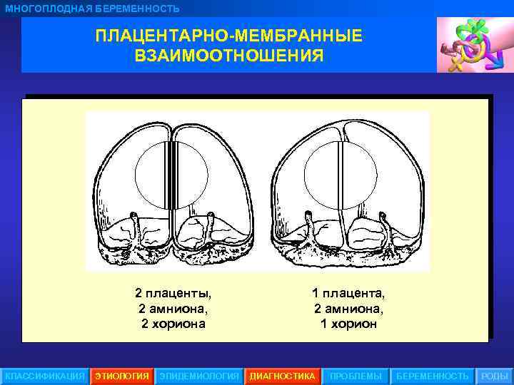 МНОГОПЛОДНАЯ БЕРЕМЕННОСТЬ ПЛАЦЕНТАРНО-МЕМБРАННЫЕ ВЗАИМООТНОШЕНИЯ 2 плаценты, 2 амниона, 2 хориона КЛАССИФИКАЦИЯ ЭТИОЛОГИЯ ЭПИДЕМИОЛОГИЯ 1