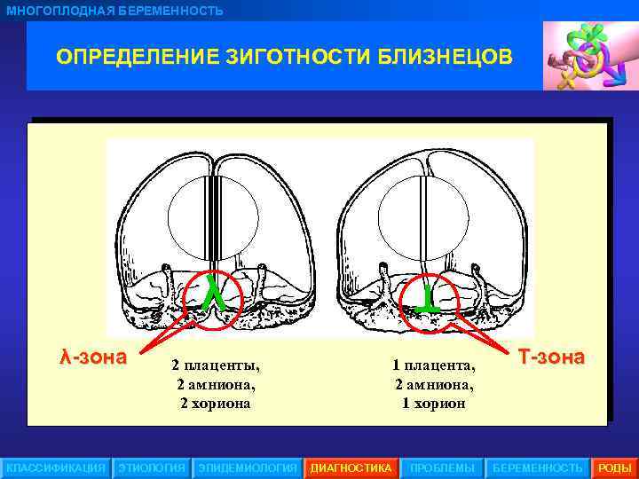 Признаки многоплодной беременности