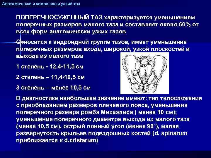 Анатомически и клинически узкий таз ПОПЕРЕЧНОСУЖЕННЫЙ ТАЗ характеризуется уменьшением поперечных размеров малого таза и