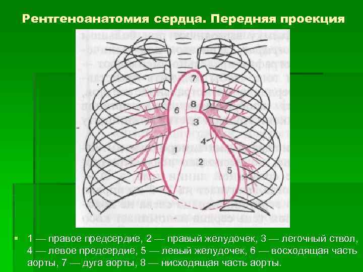 Рентгеноанатомия сердца. Передняя проекция § 1 — правое предсердие, 2 — правый желудочек, 3