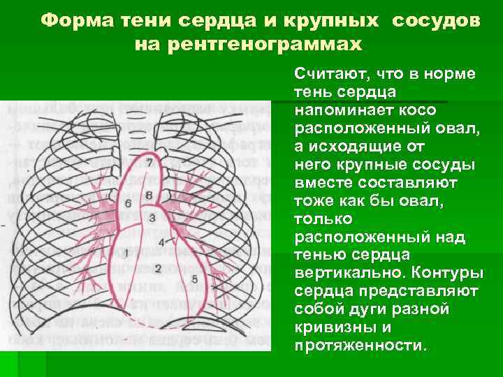 Форма тени сердца и крупных сосудов на рентгенограммах Считают, что в норме тень сердца