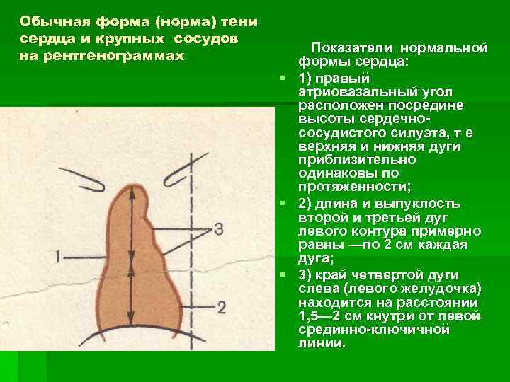 Обычная форма (норма) тени сердца и крупных сосудов на рентгенограммах § § § Показатели