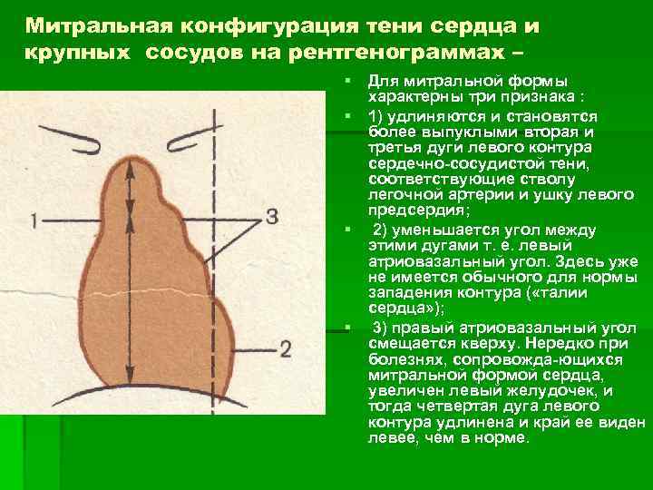 Понятие о дугах сердца рисунок