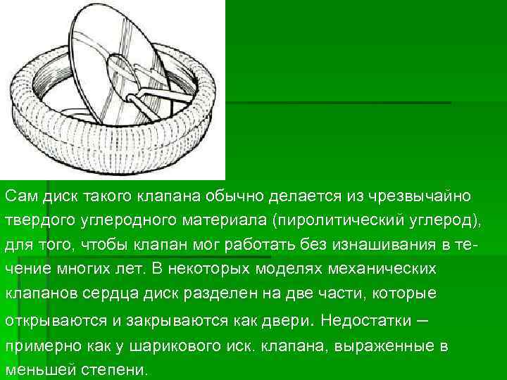 Сам диск такого клапана обычно делается из чрезвычайно твердого углеродного материала (пиролитический углерод), для