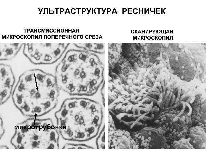 УЛЬТРАСТРУКТУРА РЕСНИЧЕК ТРАНСМИССИОННАЯ МИКРОСКОПИЯ ПОПЕРЕЧНОГО СРЕЗА микротрубочки СКАНИРУЮЩАЯ МИКРОСКОПИЯ 