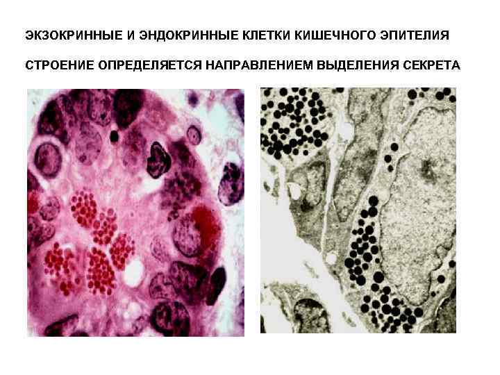 ЭКЗОКРИННЫЕ И ЭНДОКРИННЫЕ КЛЕТКИ КИШЕЧНОГО ЭПИТЕЛИЯ СТРОЕНИЕ ОПРЕДЕЛЯЕТСЯ НАПРАВЛЕНИЕМ ВЫДЕЛЕНИЯ СЕКРЕТА 