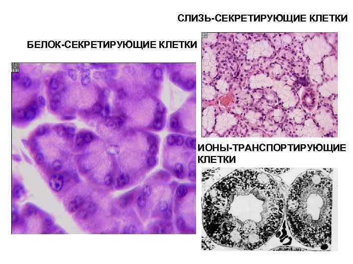СЛИЗЬ-СЕКРЕТИРУЮЩИЕ КЛЕТКИ БЕЛОК-СЕКРЕТИРУЮЩИЕ КЛЕТКИ ИОНЫ-ТРАНСПОРТИРУЮЩИЕ КЛЕТКИ 