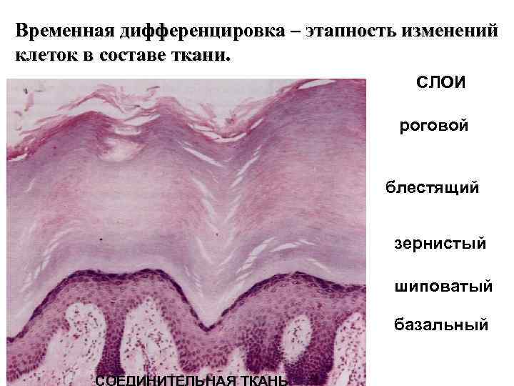 Дифференцировка на слои. Шиповатый эпителий. Базальный шиповатый зернистый блестящий роговой. Шиповатый слой гистология. Шиповатый слой эпителия.