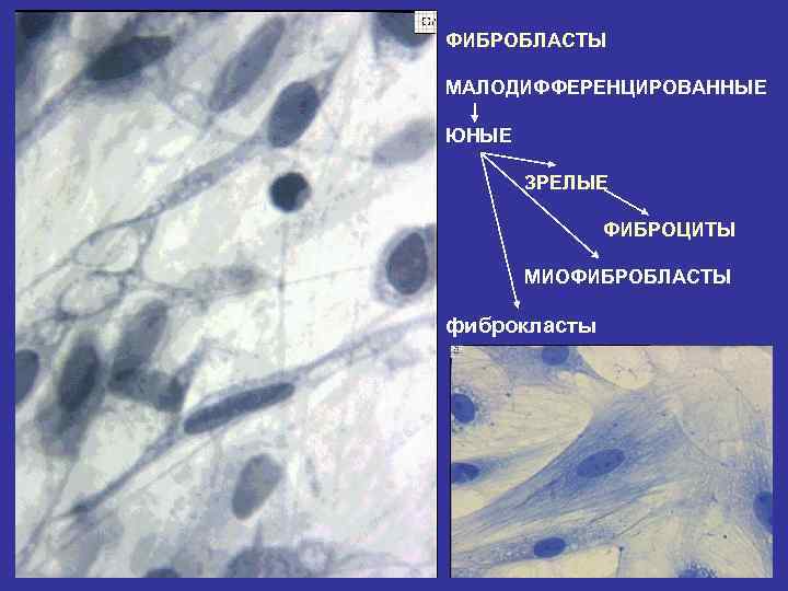 ФИБРОБЛАСТЫ МАЛОДИФФЕРЕНЦИРОВАННЫЕ ЮНЫЕ ЗРЕЛЫЕ ФИБРОЦИТЫ МИОФИБРОБЛАСТЫ фиброкласты 