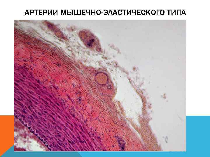 Артерии эластического типа гистология рисунок