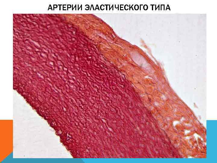 АРТЕРИИ ЭЛАСТИЧЕСКОГО ТИПА 
