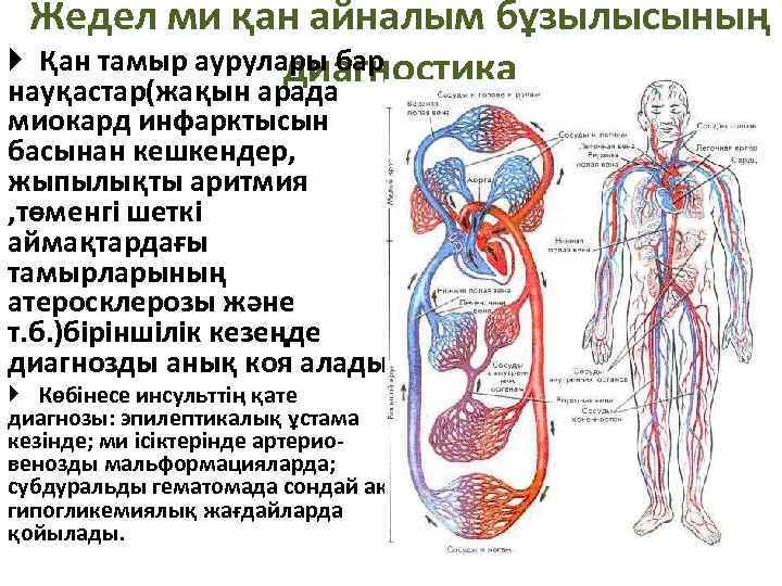 Жедел ми қан айналым бұзылысының Қан тамыр аурулары бар диагностика науқастар(жақын арада миокард инфарктысын