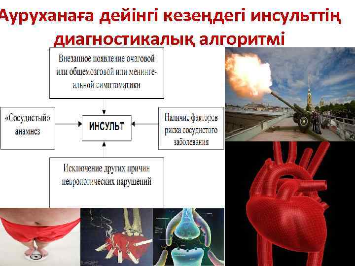 Ауруханаға дейінгі кезеңдегі инсульттің диагностикалық алгоритмі 