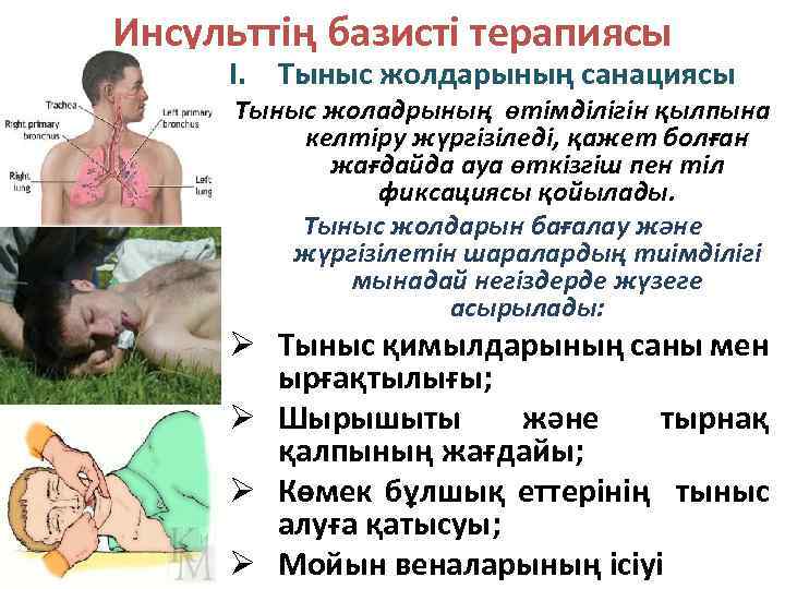 Инсульттің базисті терапиясы I. Тыныс жолдарының санациясы Тыныс жоладрының өтімділігін қылпына келтіру жүргізіледі, қажет