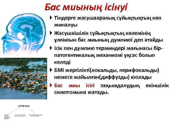 Бас миының ісінуі Тіндерге жасушааралық сұйықтықтың көп жиналуы Жасушаішілік сұйықтықтың көлемінің ұлғаюын бас миының