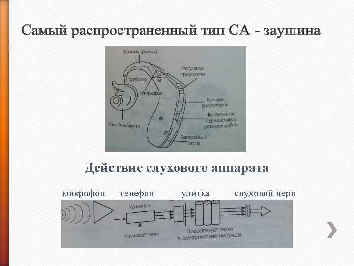 Самый распространенный тип СА - заушина Действие слухового аппарата микрофон телефон улитка слуховой нерв