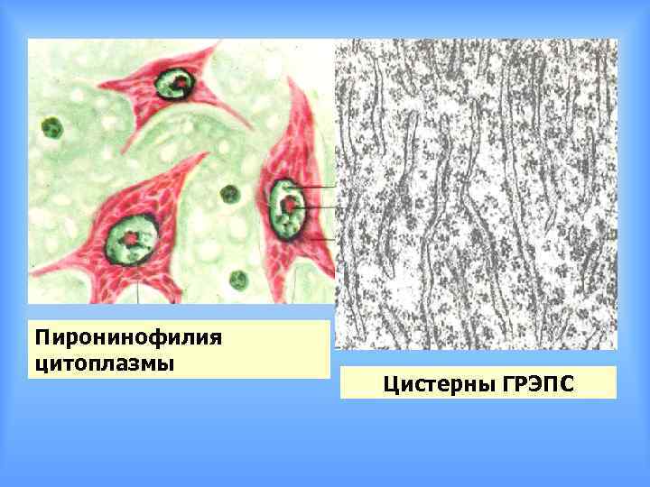 Пиронинофилия цитоплазмы Цистерны ГРЭПС 