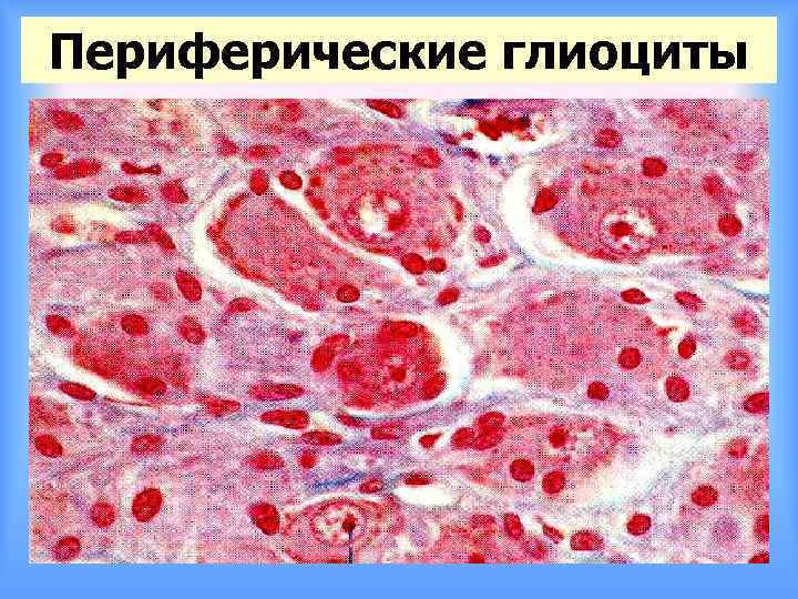 Периферические глиоциты 