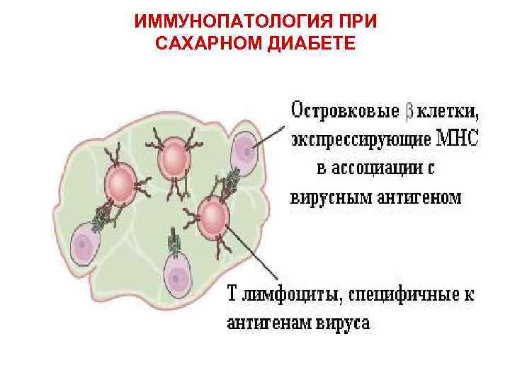 ИММУНОПАТОЛОГИЯ ПРИ САХАРНОМ ДИАБЕТЕ 