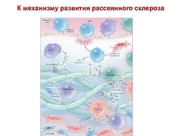 К механизму развития рассеянного склероза • • • Figure 4. The Multiple Sclerosis Plaque.