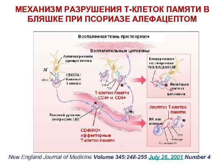 МЕХАНИЗМ РАЗРУШЕНИЯ Т-КЛЕТОК ПАМЯТИ В БЛЯШКЕ ПРИ ПСОРИАЗЕ АЛЕФАЦЕПТОМ New England Journal of Medicine