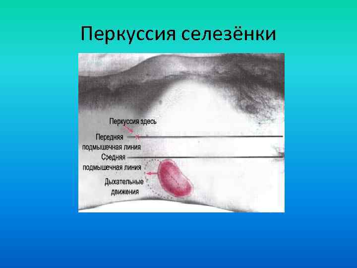 Селезенка см2. Длинник и поперечник селезенки. Перкуссия селезенки длинник поперечник. Границы селезенки по курлову в норме. Перкуссия селезенки по курлову алгоритм.