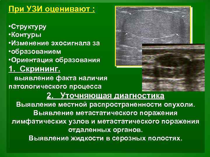 При УЗИ оценивают : • Структуру • Контуры • Изменение эхосигнала за • образованием