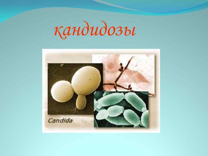 кандидозы 