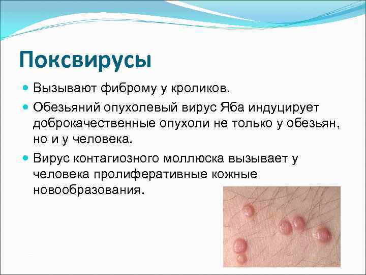 Поксвирусы Вызывают фиброму у кроликов. Обезьяний опухолевый вирус Яба индуцирует доброкачественные опухоли не только