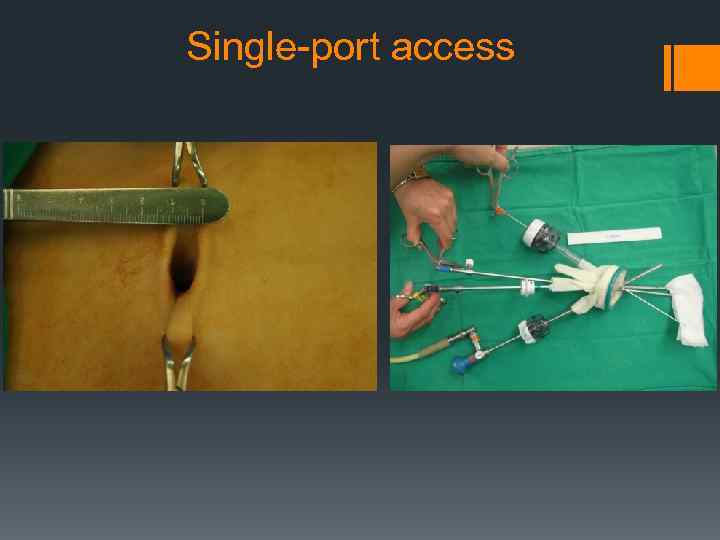 Single-port access 